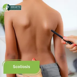 Scolosis