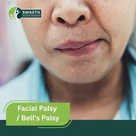Facial Palsy / Bell's Palsy