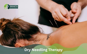 Dry Needling Therapy